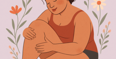 Lipedema2